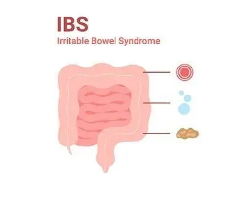 Irritable bowel syndrome and its common drugs